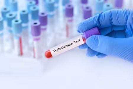 Testosterone