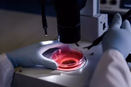 Cord Tissue Therapies Offer New Hope for SA Patients Cord Tissue Therapies