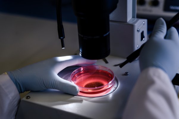 Cord Tissue Therapies Offer New Hope for SA Patients 3 Cord Tissue Therapies